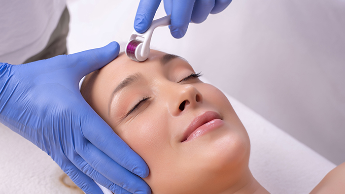 microneedling treatment