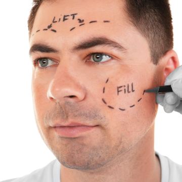 Male Facelift
