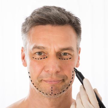 Male Facelift copy