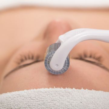 Microneedling