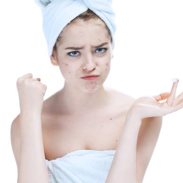 Acne treatment