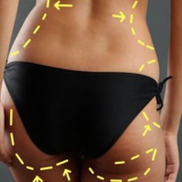 Body contouring 300