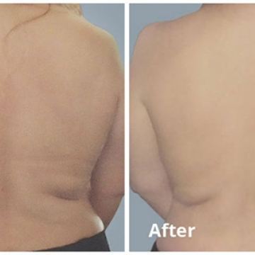 Bodyfx ba1