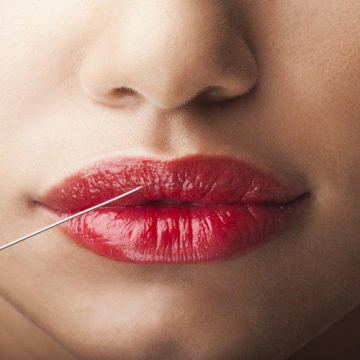 Botoxlips