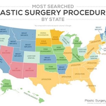 Infographic