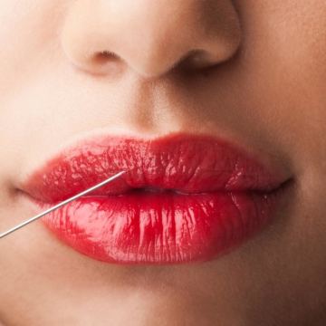 Lip injections