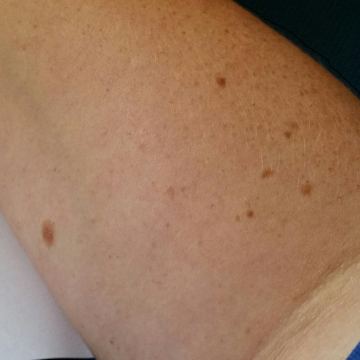 Moles
