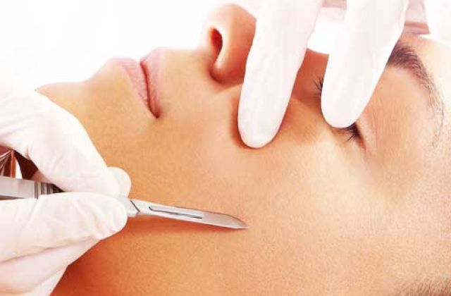 Dermaplaning