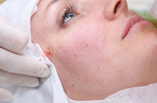 Thread Facelift