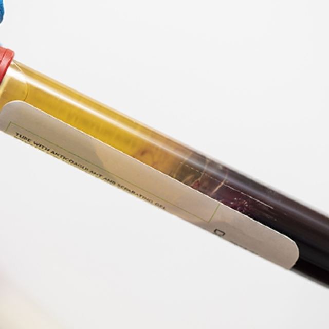 Amspa prp 103020