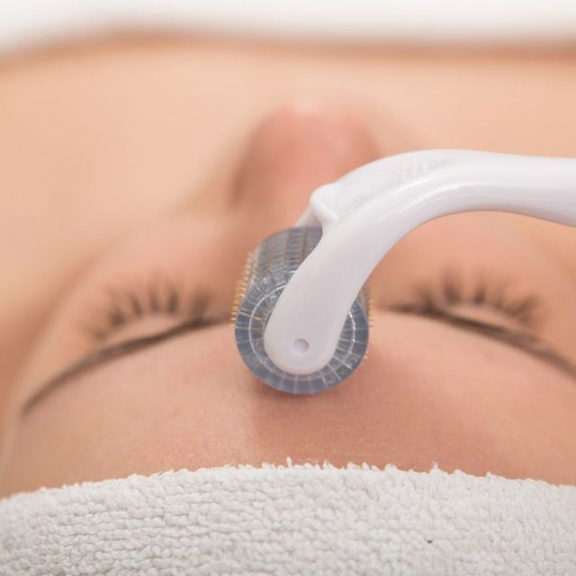 Microneedling med spa treatments