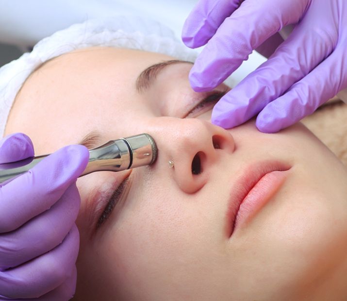 Dermabrasion
