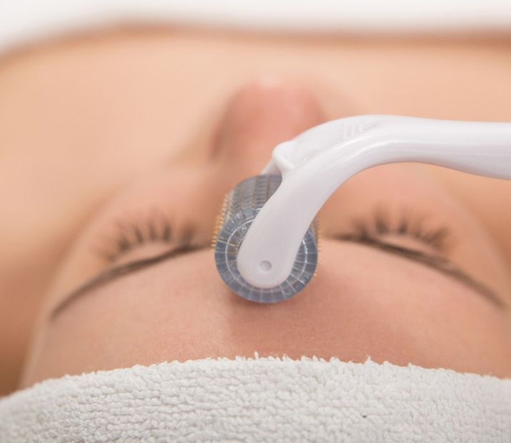 Microneedling