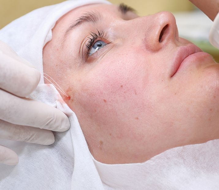 Thread Facelift