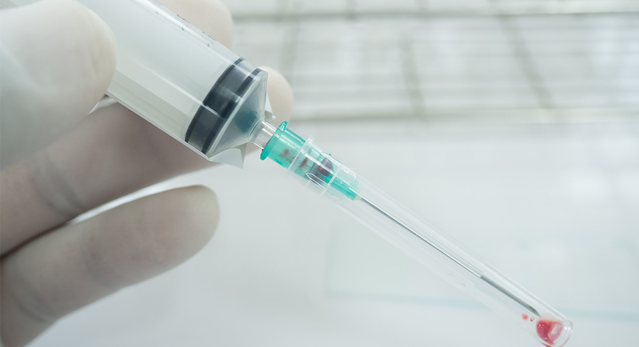 Aspiration in Filler Injections