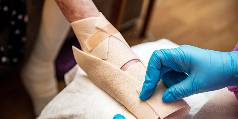doctor wrapping limb with epidermolysis bullosa