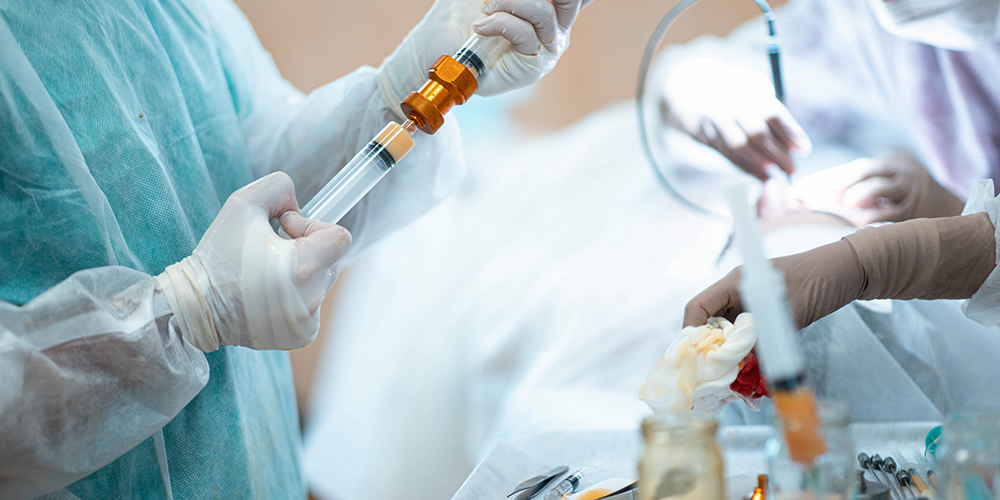Liposuction before stem cell therapy procedure