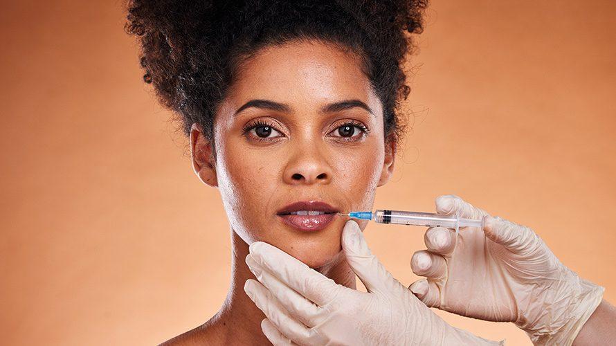 Lip filler